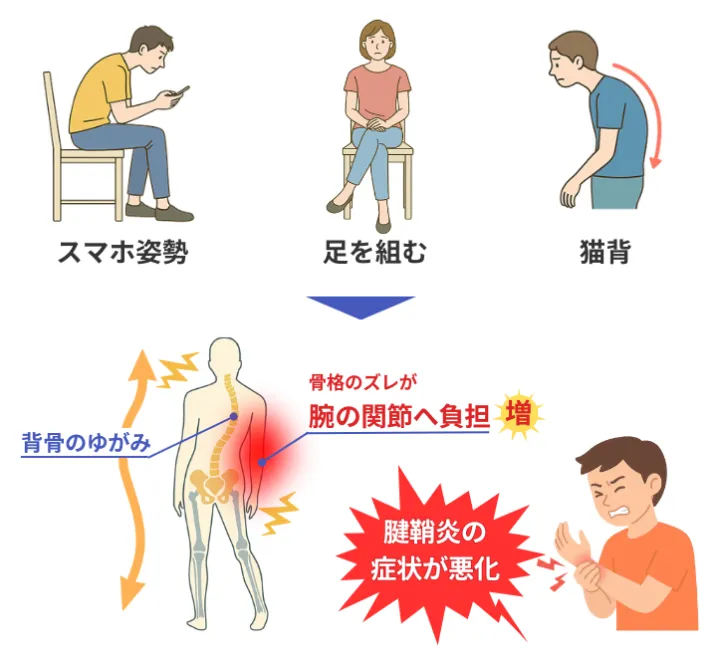腱鞘炎の根本原因02