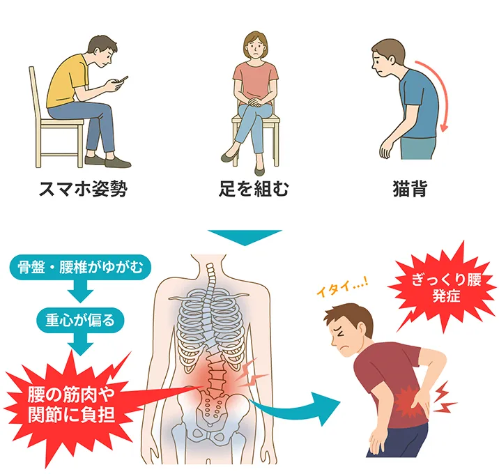 ぎっくり腰の根本原因02