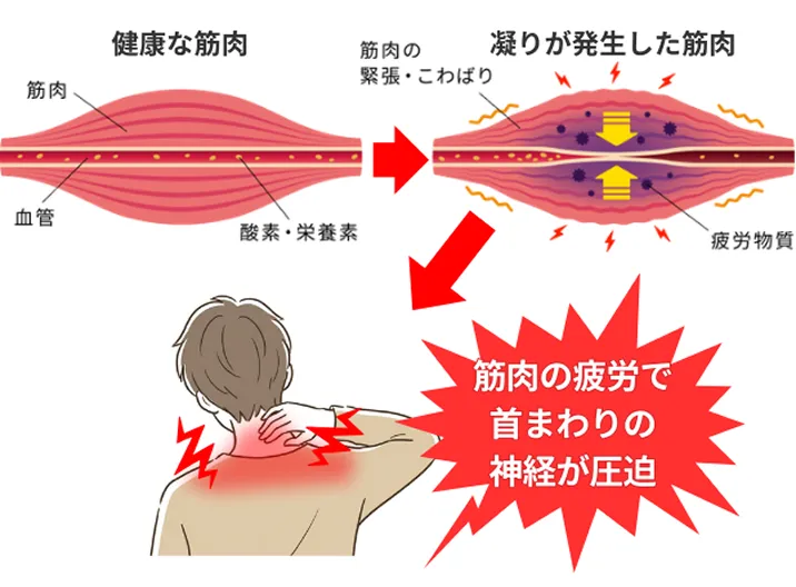 めまいの根本原因03