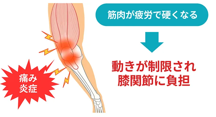 膝痛の根本原因03